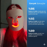 KORAEA GLOW MASK KIRMIZI IŞIK TEKNOLOJİLİ YÜZ MASKESİ