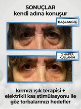 Koraea Revive Kırmızı Işık ve EMS Teknolojili Gözaltı Maskesi