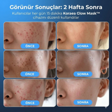 KORAEA GLOW MASK KIRMIZI IŞIK TEKNOLOJİLİ YÜZ MASKESİ